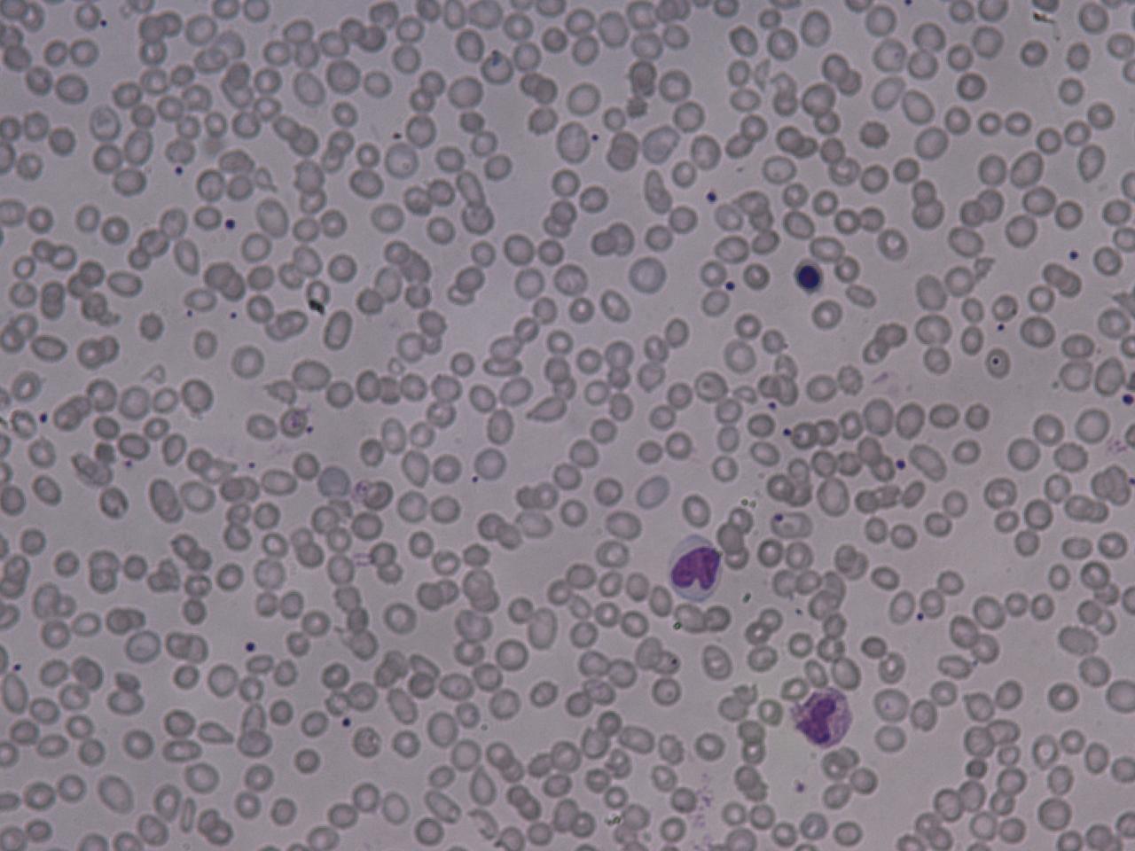 haematology-watch